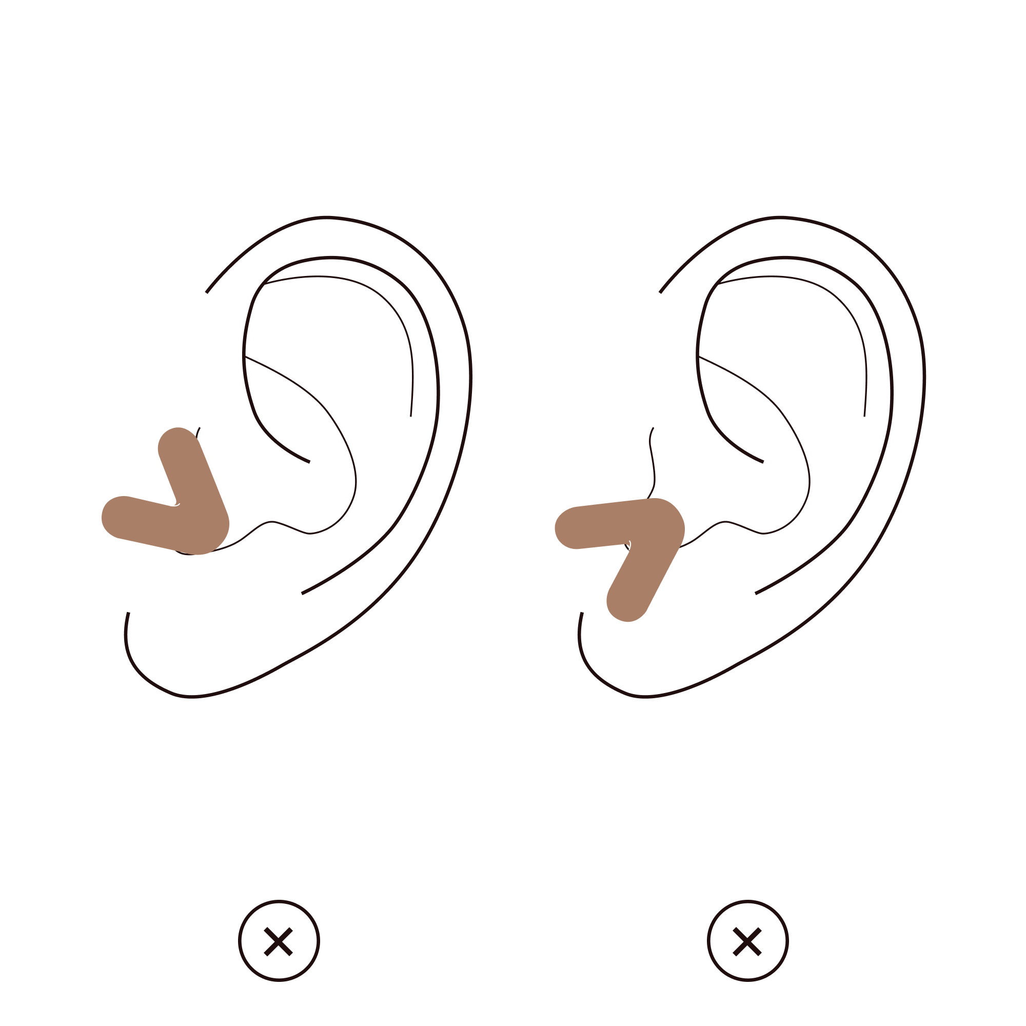 Benutzungserklaerung Schritt 4 Alpine Tune richtig einsetzen